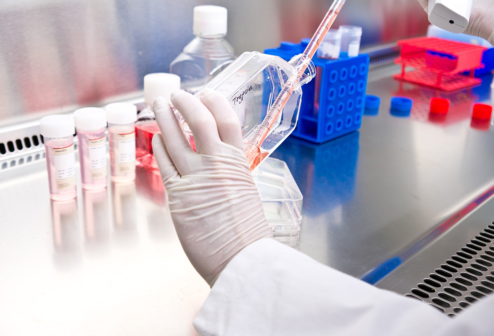 細胞検査　イメージ画像