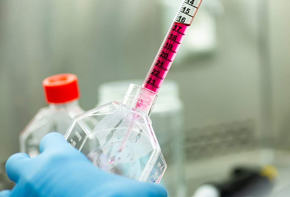 細胞検査　イメージ画像